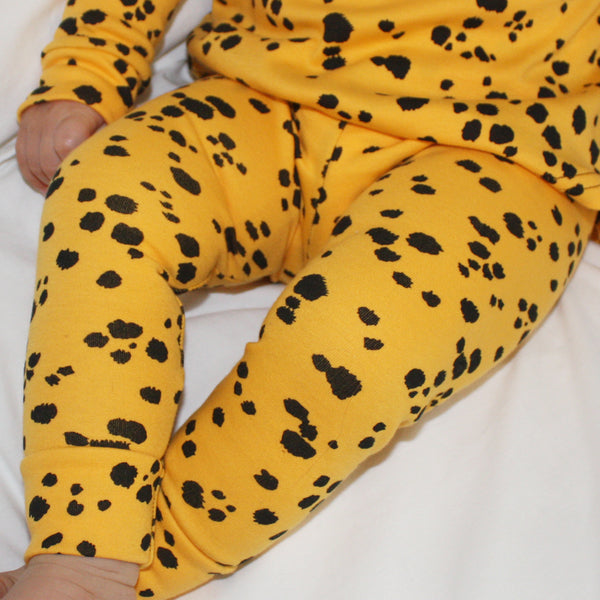 Lounge Set - Yellow Dalmatian Spots
